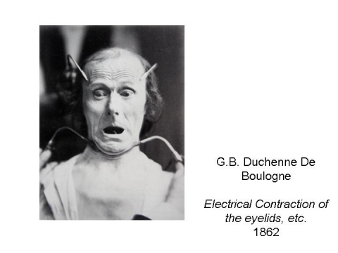 G.B. Duchenne De Boulogne  Electrical Contrac